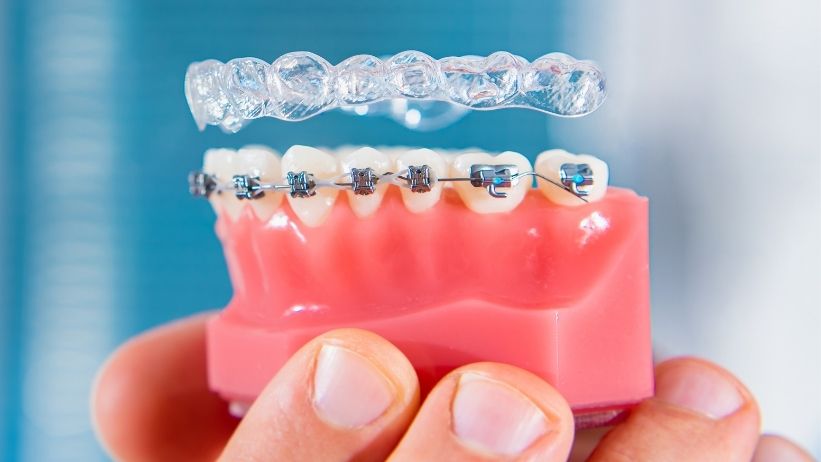 The sudden onset of orthodontic treatment may alter our overall